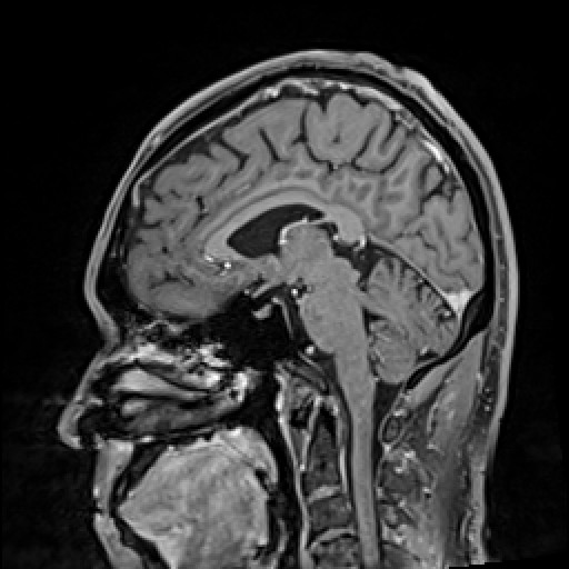 Click on the Serie image to view the images of VILLANUEVA, WILLIAM A.